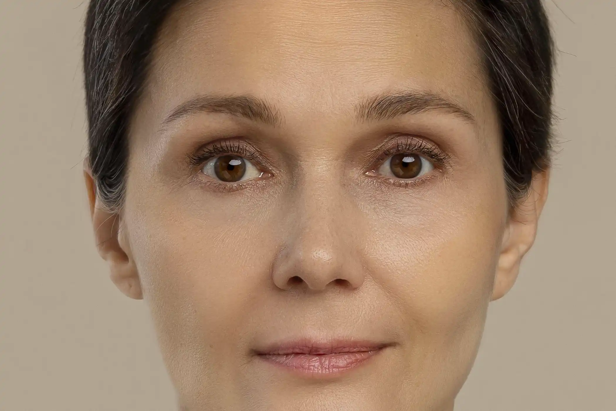 antiaging-beauty-treatment_18992374-after